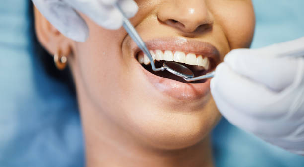 Best Emergency Broken Tooth Repair in Brainerd, MN